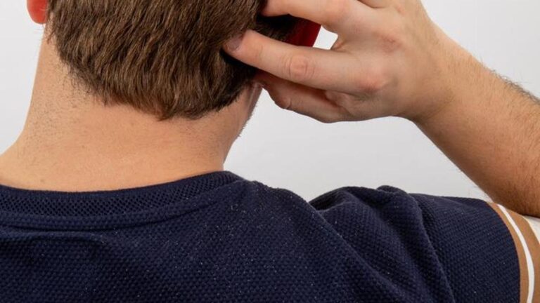 Metal aksesuarlarına ve tekstil boyasına dikkat edin: Egzamanın gizli tetikleyicileri